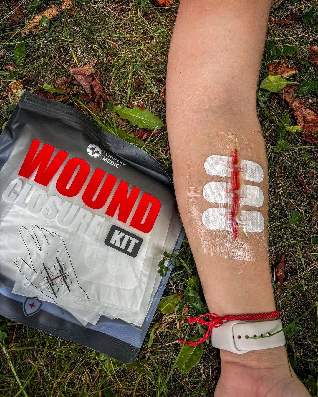 imgi_226_Advanced_Wound_Closure_Kit_-_62135