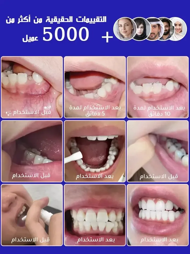 imgi_3_9a9ed8946639ce35c311b6991c0b630b9f070f9e40a1d4b9ed64404878ff8b68