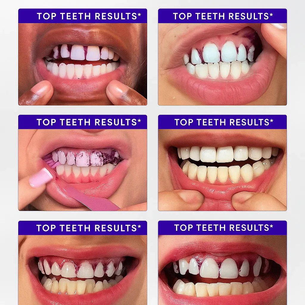 imgi_118_b0bf50d23ac44a7f06e7_20251013_0059_Teeth_Whitening_Results_remix_01k7e96dcve87an3jsfrscb0dz