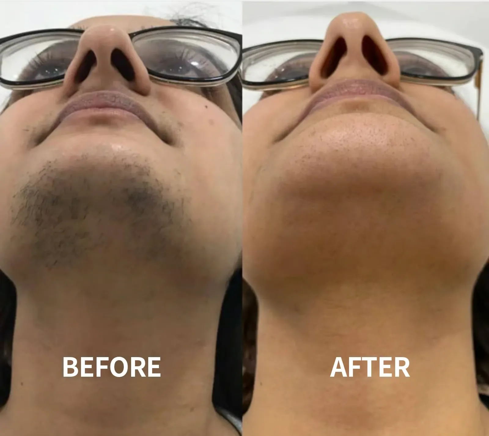 imgi_25_54371a463630f565a15b033cb7d25c27b1e05de4