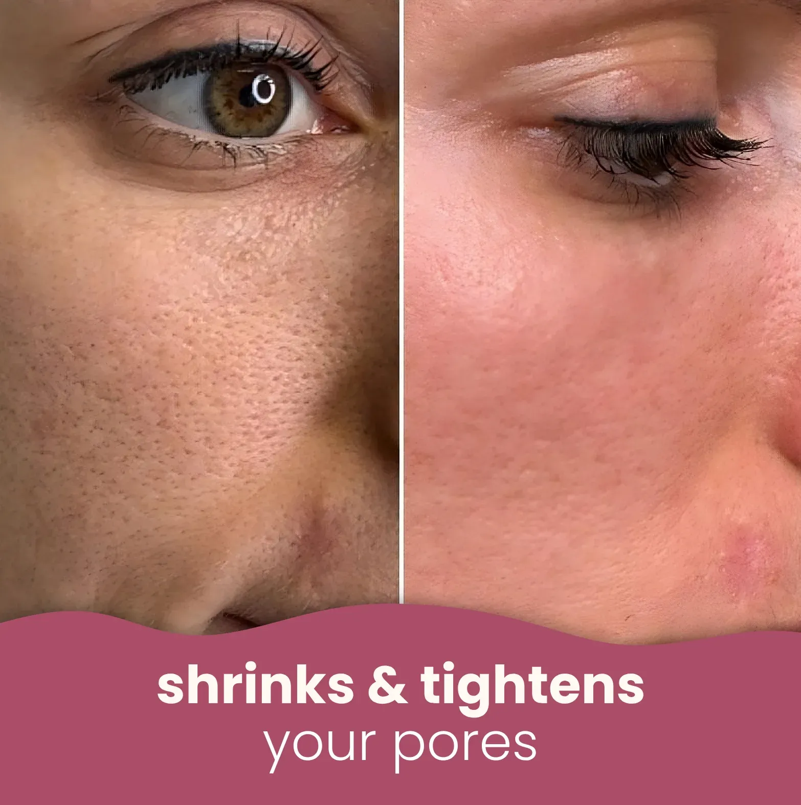 imgi_194_2023-09_Mesotox-transformed